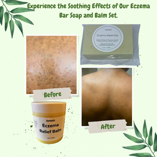 Eczema Care Bundle