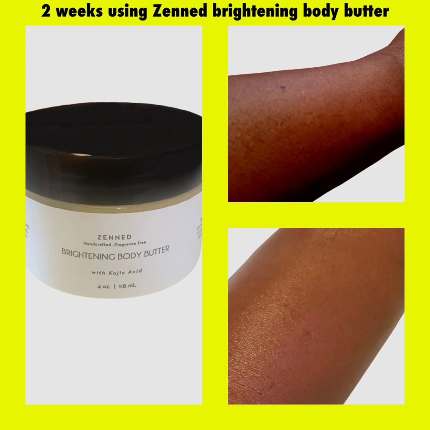 Brightening Body Butter with Kojic Acid