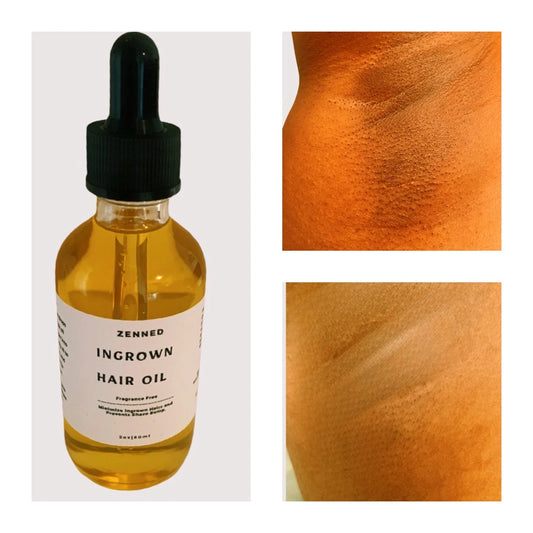 Ingrown Hair Oil